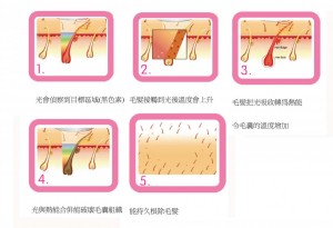 TRY 5